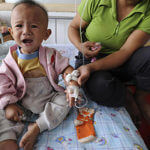 Child poisoned by melamine tainted milk gets treatment in hospital in China.